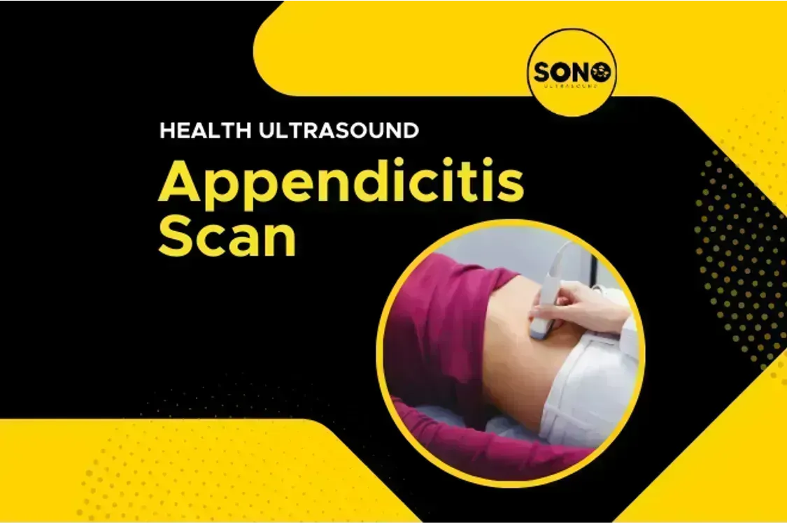 Appendicitis Scan (Appendix Ultrasound)